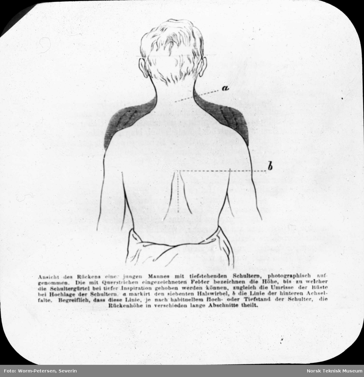 Figur anatomi, ung manns rygg