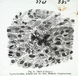 Typhusbasiller
