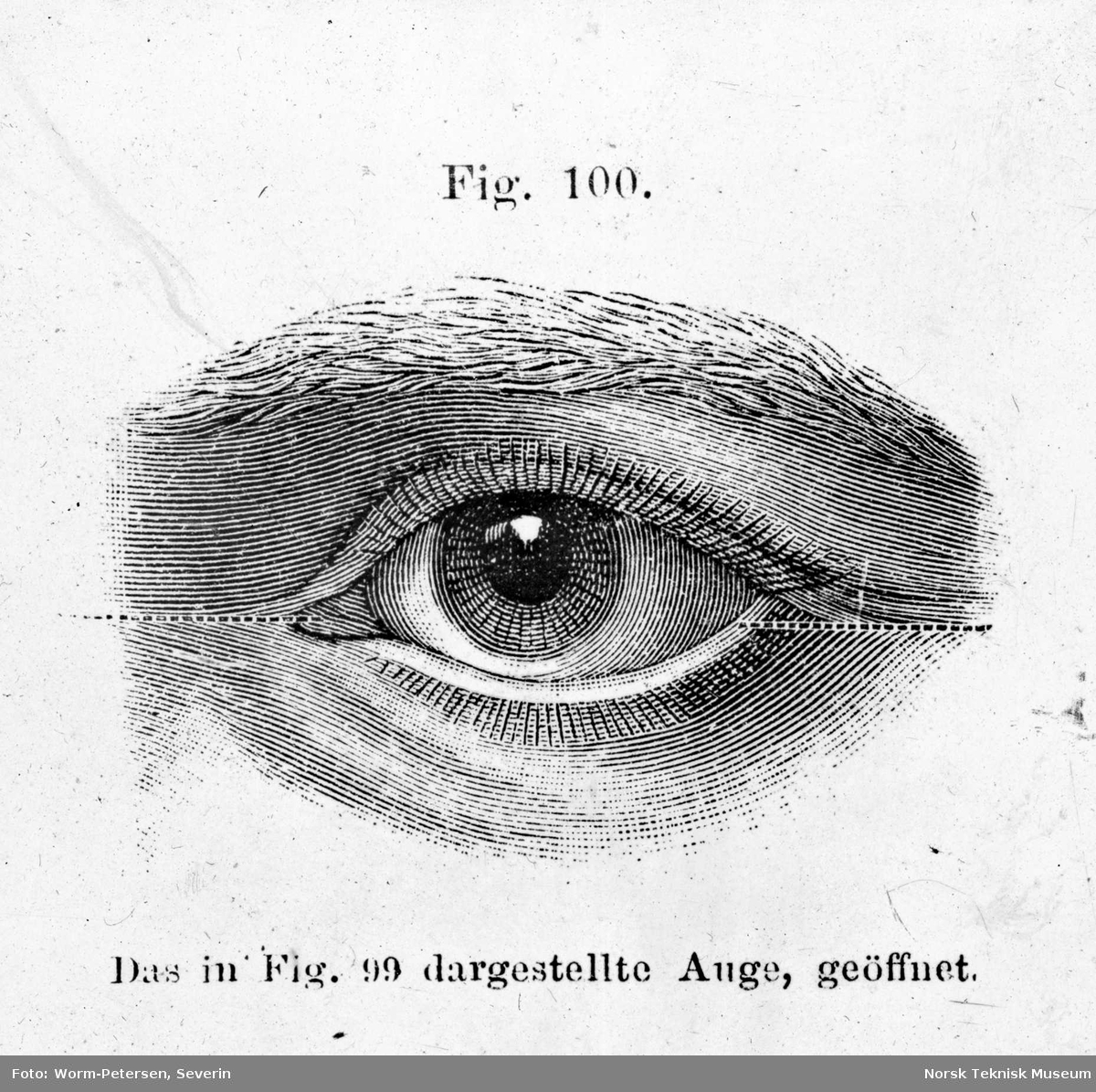 Anatomi; Øyet. Øyespalten, åpen.