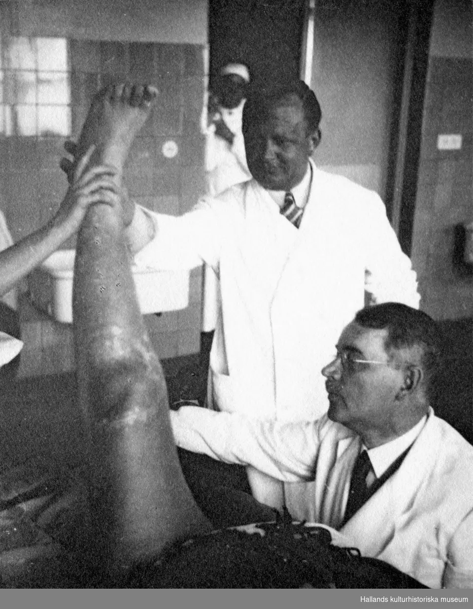 Dr Hanson med kollegor på Kustsanatoriet Apelviken i arbete med en patients ben. Sanatoriet fick en ny operations- och gipsavdelning 1933 så troligen har man här dokumenterat arbetet i de nya lokalerna.